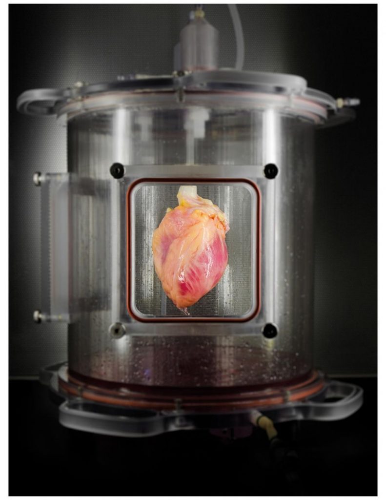 Scientists Grow Full-Sized, Beating Human Hearts From Stem Cells