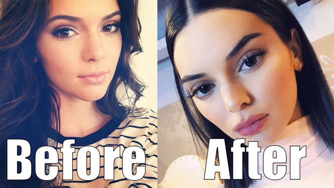 Kendall Jenner TOTALLY Just got Plastic Surgery! She looks Completely Different!