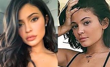 Kylie Jenner REMOVES Lip Fillers & Posts Natural Photo