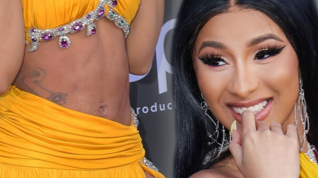 Cardi B admits to Liposuction after Kulture’s Birth